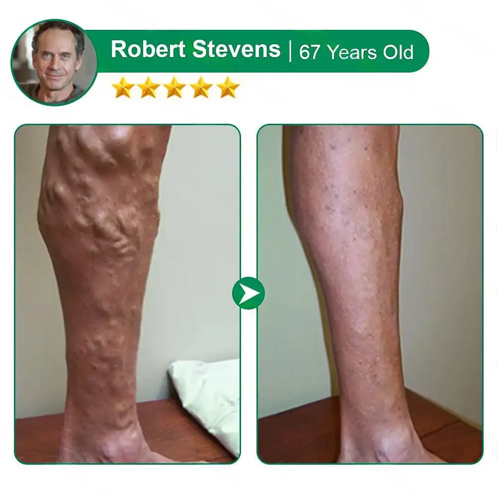 ๐ฆต๐ฆต๐ฆตClearenaยฎ VeinTarget Microneedle Patch โโ Once Daily, Visible Results in 7 Days - Image 12
