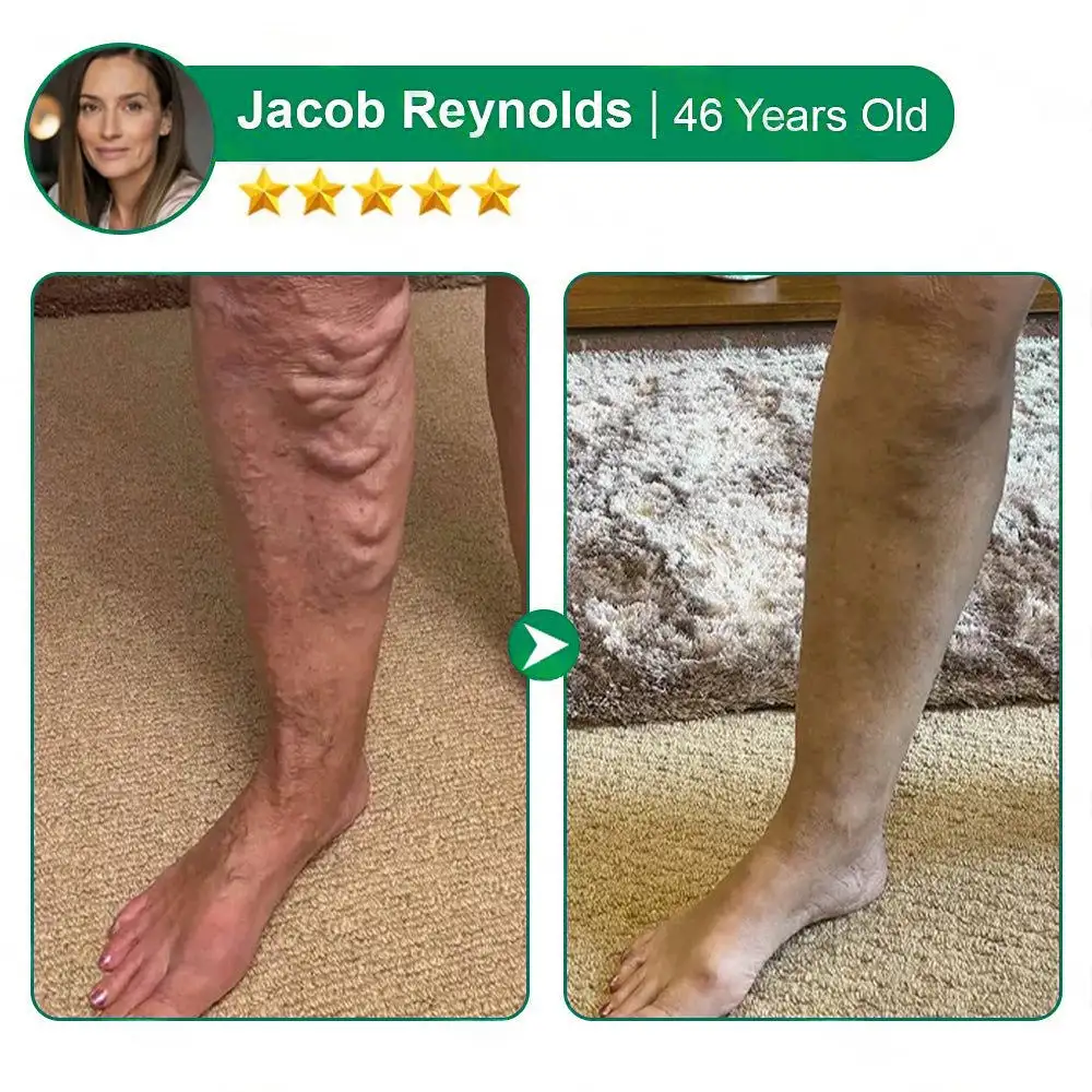 ๐ฆต๐ฆต๐ฆตClearenaยฎ VeinTarget Microneedle Patch โโ Once Daily, Visible Results in 7 Days - Image 6