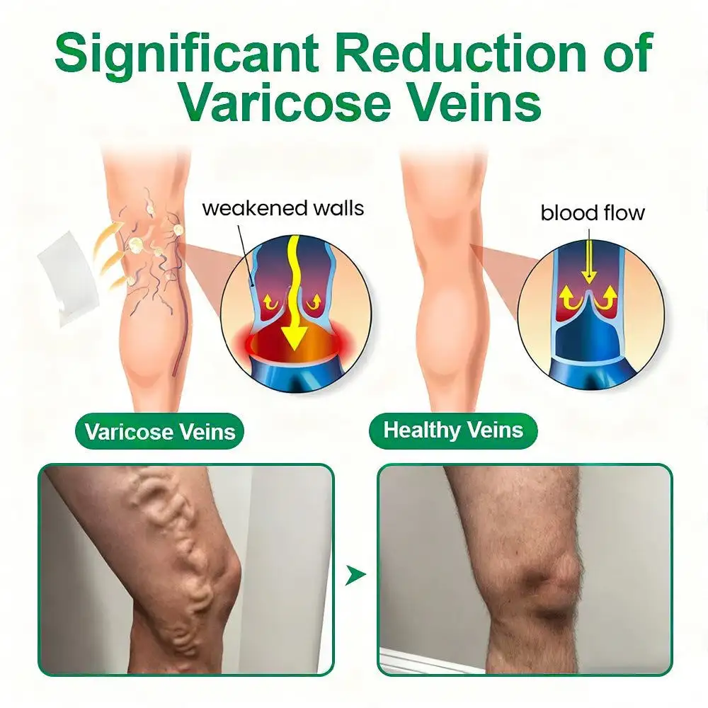 ๐ฆต๐ฆต๐ฆตClearenaยฎ VeinTarget Microneedle Patch โโ Once Daily, Visible Results in 7 Days - Image 8